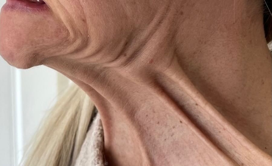 Før