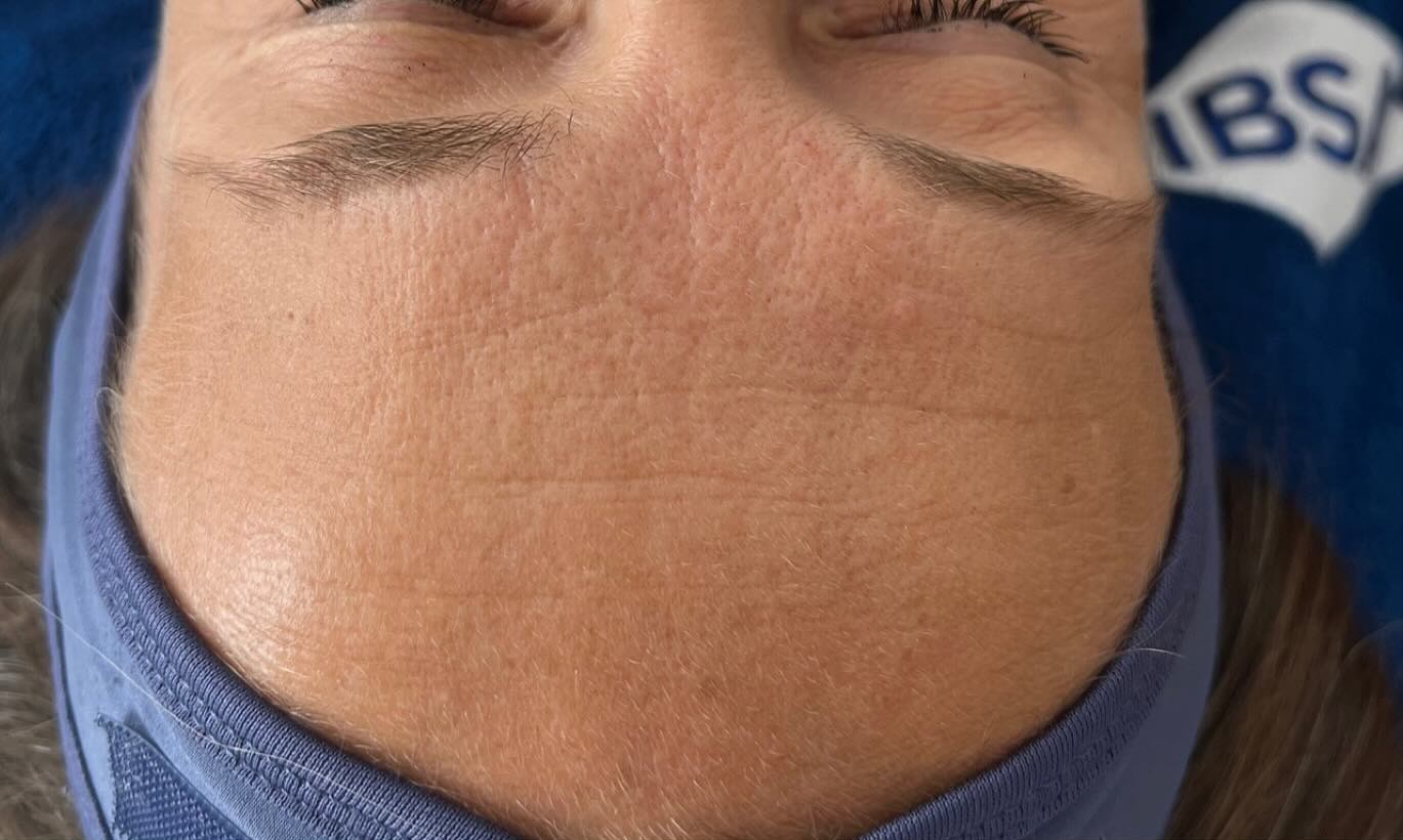 Før